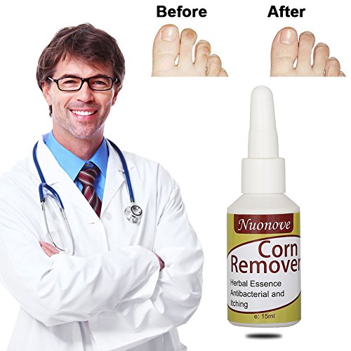 Corn Remover, Corn Removal, Corn Remover Liquid, Foot Corn Removal, Corn Callus Remover, 15ml