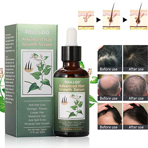 Hair Growth Serum for Thicker, Longer, Fuller Hair - Prevents Loss and Thinning with Vitamin-Rich Natural Treatment - Image 3