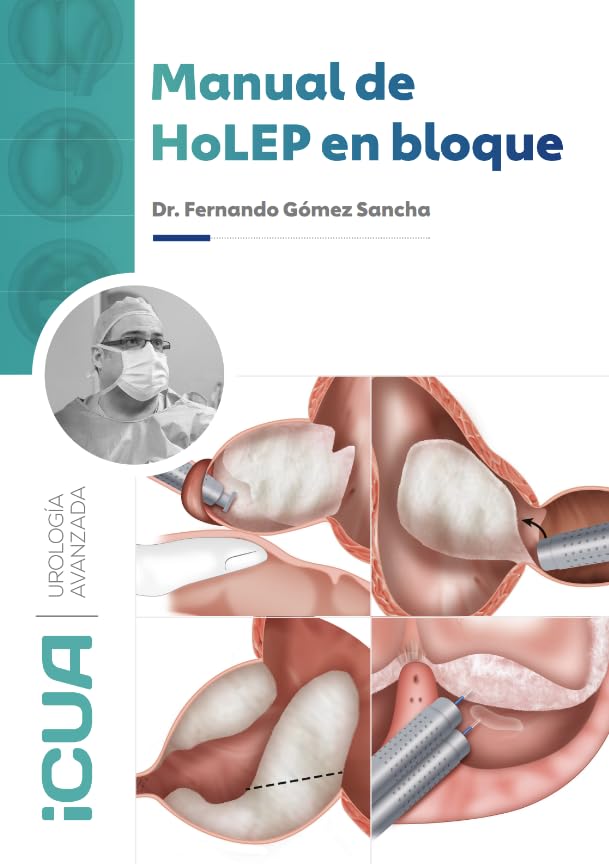 Manual HOLEP en Bloque (Edición en Español)