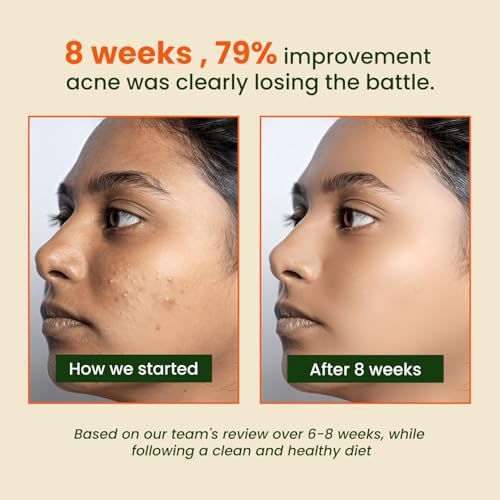 Image of Herbalmax Veg Collagen Supplements Beauty Builder 195g | Plant-Based Collagen Powder for Hair, Skin, Nails & Joints | With Vitamin C & E | Mixed Fruit Flavour | Gluten-Free, No Added Sugar