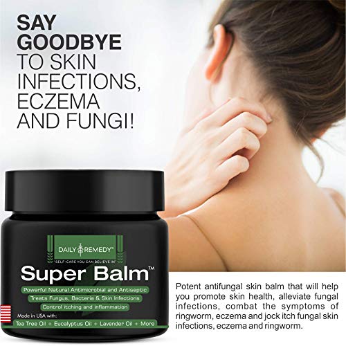 Antifungal Balm - Made in USA - Helps Treat Eczema, Ringworm, Jock Itch, Athletes Foot and Nail Fungal Infections - Best Ointment to Soothes Itchy, Scaly or Cracked Skin