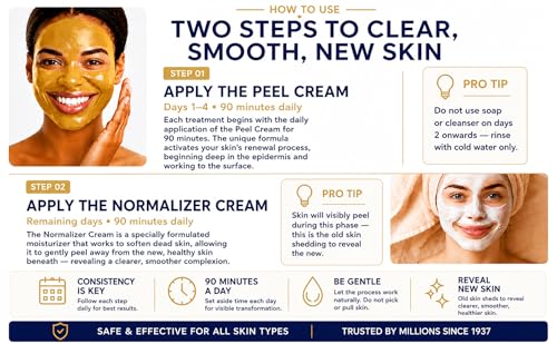 Cicatrices d'acné solution avec peeling Skin Culture 4000 - 5