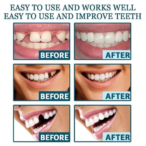 Image of Adjustable for Men and Women, Replacement Missing and Broken, Nature and Comfortable, Beautiful Smile