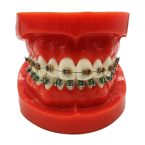 FHUILI Dental KFO-Demonstrationsmodell - Dental Teeth Studie Lehre Modell - Typodont Zähne Modell mit Mental Brackets - Simulation Oral Zahn KFO Zähne Modell mit Ligatur Krawatten,S Cover