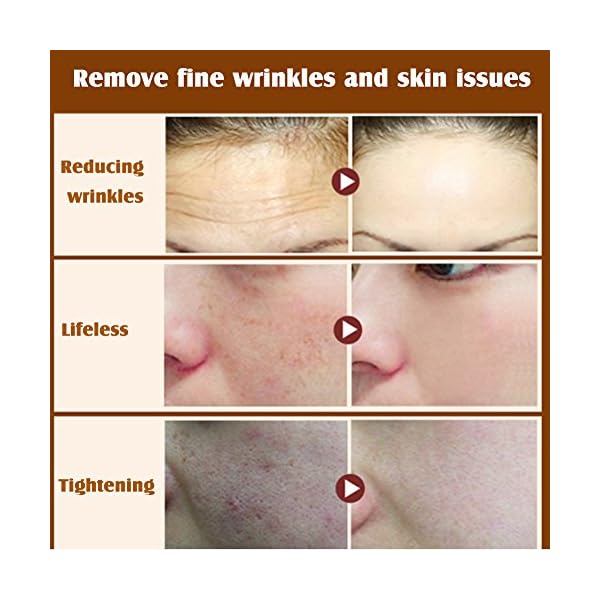 Anti-Wrinkle-Face-Cream-Face-Repair-Day-Night-Cream-Moisturiser-Six-Peptide-Anti-wrinkling-Facial-Cream-that-Anti-aging-Moisturing-Wrinkles-Removal-Reduce-Sagging-Lifting-and-Tighten-Skin Anti-Aging Face Cream, Face Repair Day & Night Cream Moisturiser, Six Peptide Anti-Wrinkle Facial Cream that Wrinkle Repair, Moisturing, Firm and Brighten Skin