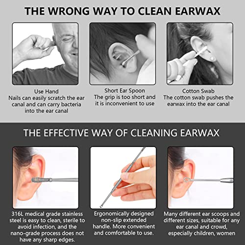 Hion Ohrenreiniger, Ohrenschmalz Entferner 6 in1 Medizinischer Ohrreiniger aus Edelstahl mit Aufbewahrungskiste Ear Cleaner, Geeignet für Kinder Jugendliche und Erwachsene(Silber)