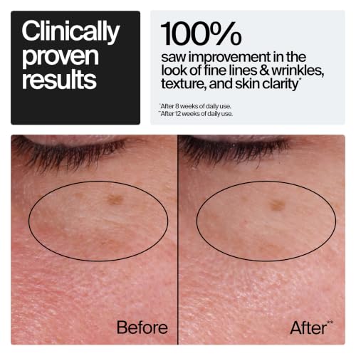 9 Best OTC Treatments for Deep Wrinkles Without Botox: A 2026 Guide 11 Neutrogena Rapid Wrinkle Repair Retinol Face Moisturizer, Daily Anti-Aging Face Cream with Retinol & Hyaluronic Acid to Fight Fine Lines, Wrinkles, & Dark Spots, 1.7 oz
