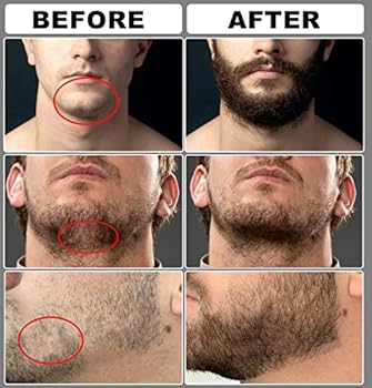 Amazon.com : Beard Growth Kit,Beard Grooming Kit w/Beard ...