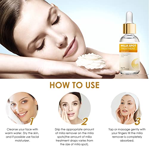 buying guides for best skin tag removal MiliaRemover MiliaTreatment