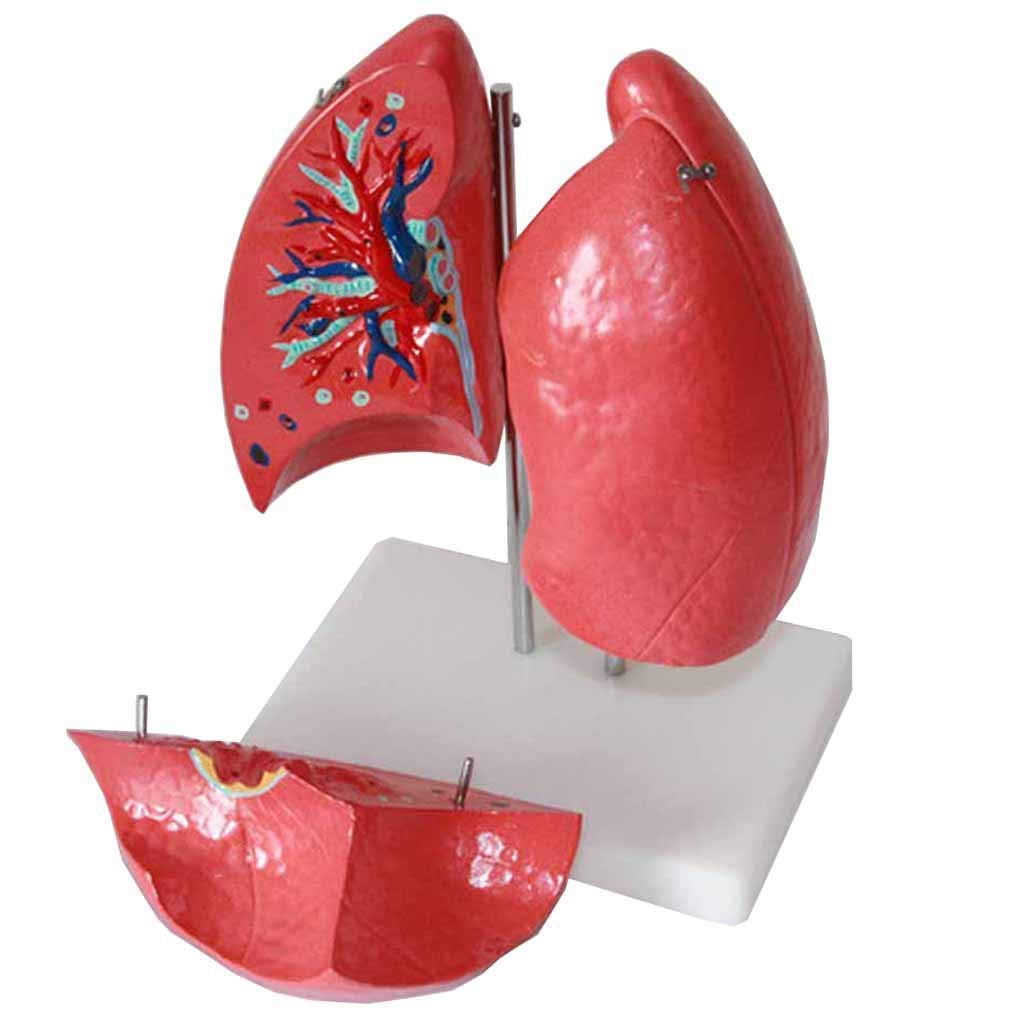 Ausbildungsmodell Medizinisches anatomisches Lungenmodell – Anatomisches Modell menschlicher Organe – Modell menschlicher Lunge – für den Unterricht von Spezialtrainingsmodellen, medizinische Ausbild