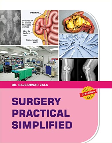 Image of Surgery practical simplified