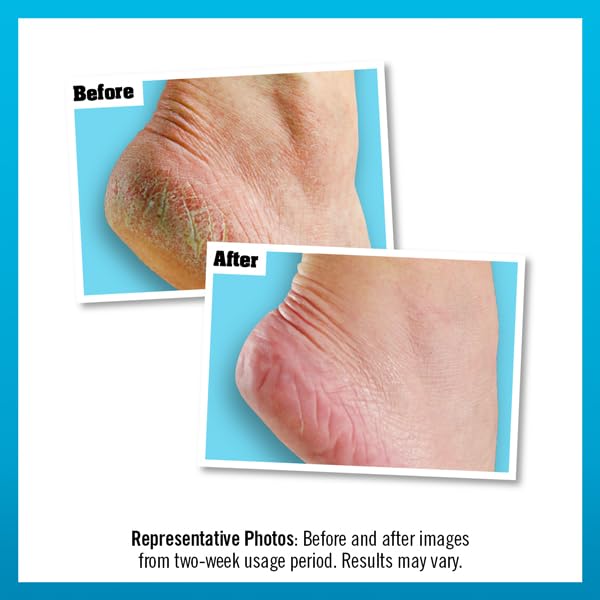 O'Keeffe's Healthy Feet 58ml (2 Pack), 58 ml (Pack of 2) - Image 3