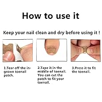 Vista 4 de Tratamiento de uñas encarnadas, 50 calcomanías de corrección de uñas encarnadas, parches correctores de uñas de los pies, herramienta profesional