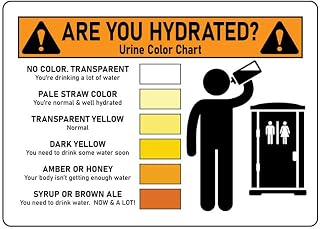 Are You Hydrated? Urine Color Chart Metal Sign Vintage Sign 12 X 8 Inch