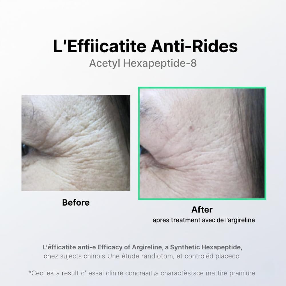 Crème Lifting Peptide 7X – Soin visage anti-âge avec 7 peptides, collagène, acide hyaluronique, céramides et niacinamide | Hydratation, fermeté et peau lissée | 50 ml