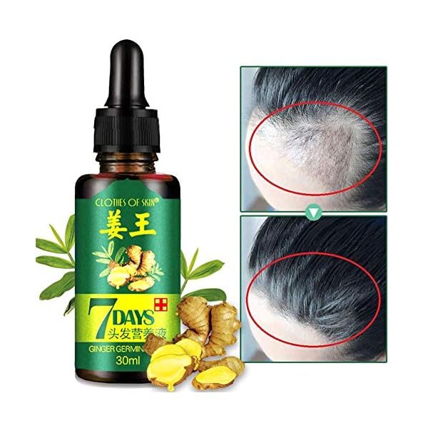 Ginger-Germinal-Oil-Ginger-Hair-Growth-Serum-Ginger-Essential-Oil-Stop-Hair-Loss-Hair-Thinning-Treatment-Hair-Growth-Oil-for-Women-Men-30ML-3-Pack Ginger Germinal Oil, Ginger Hair Growth Serum, Ginger Essential Oil Stop Hair Loss Hair, Thinning Treatment Hair Growth…