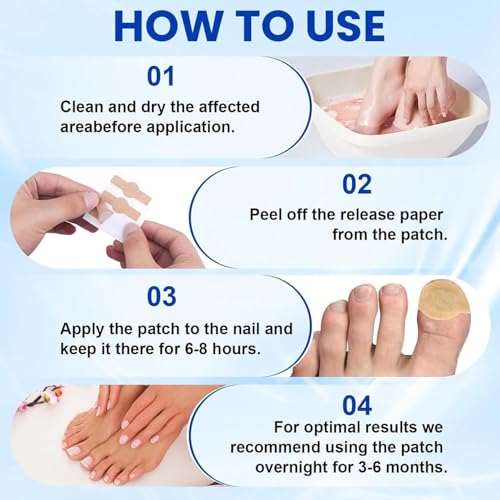 Image of Fungal Nail Repair Patches for Toenail & Fingernail Care - Hydrogel Nail Treatment Patches for Brittle, Thick and Discolored Nails | Overnight Adhesive Nail Care Strips, 10 Patches