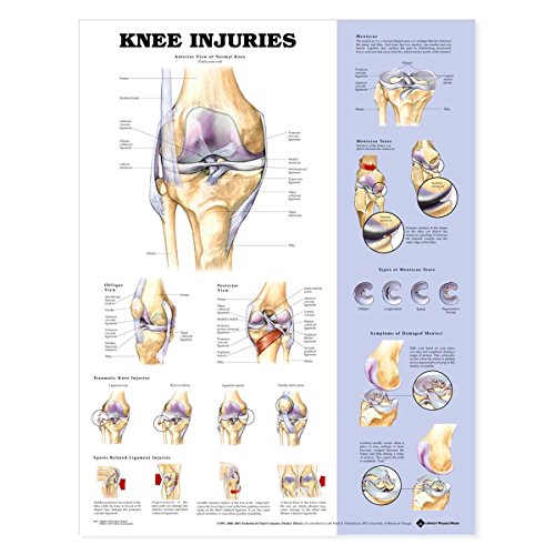 Schéma blessures du genou poster anatomie pour kiné et médecin