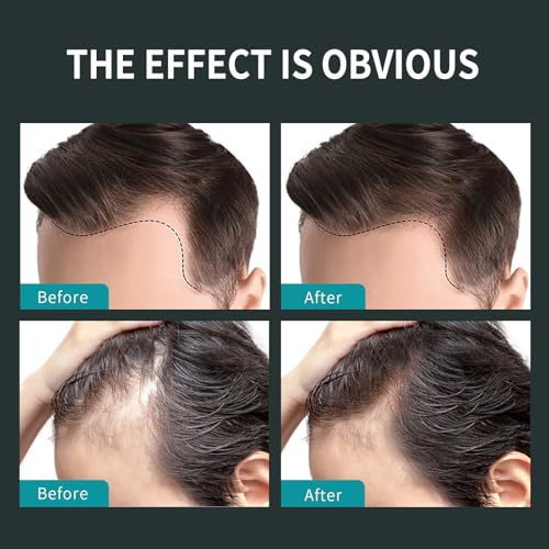 Sevich Hair Fiber Spray - Instant Hair Thickening Powder for Men & Women, Hair Building Fibers for Thinning Hair, Root Touch Up Hair Color, Waterproof, Sweatproof, Natural Look,120ml Dark Brown - Thumbnail 4