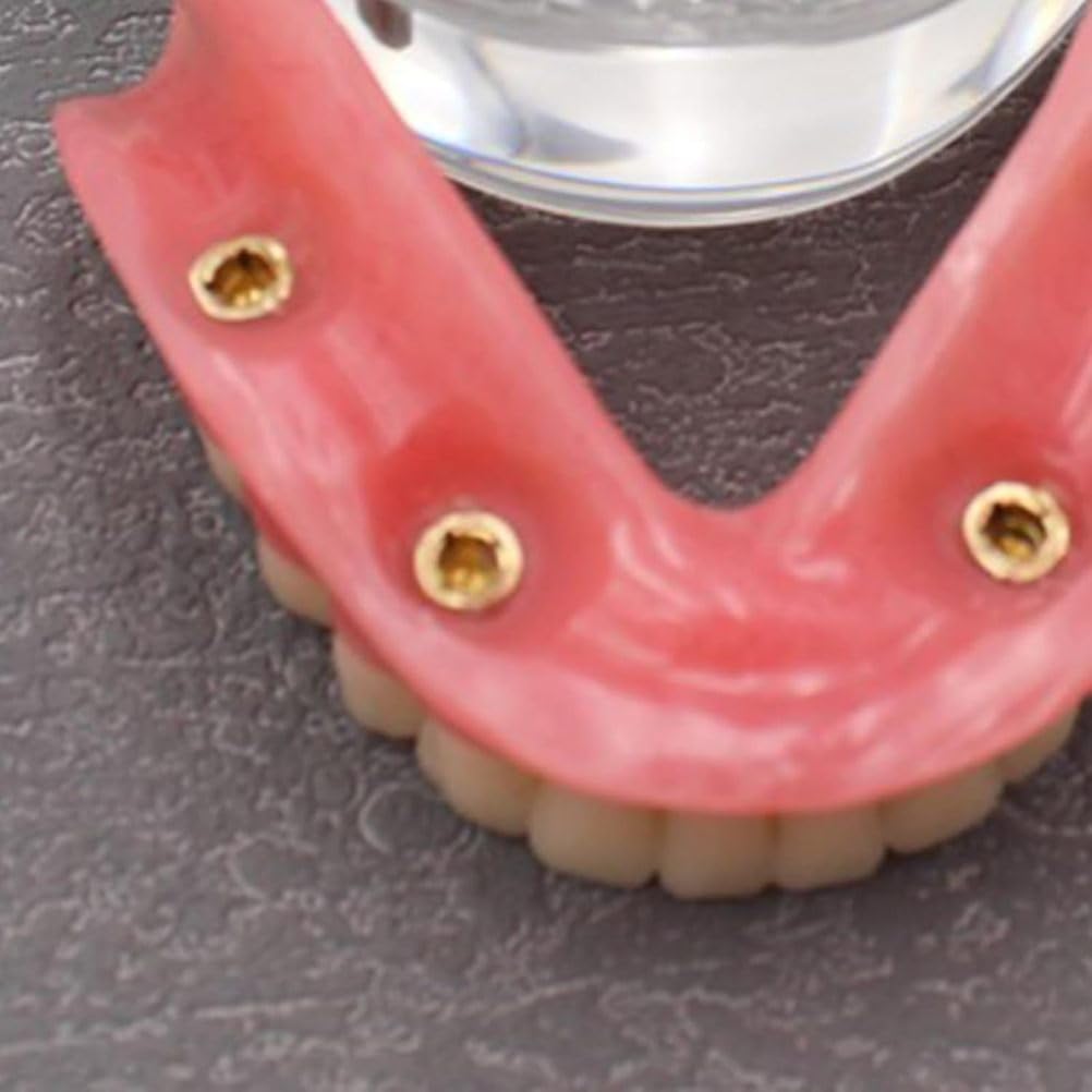 Model zębów implantów dentystycznych Wyczyść opóźnienie 4 Implanty górnej górnej bazy szczękowej do studiowania nauczania