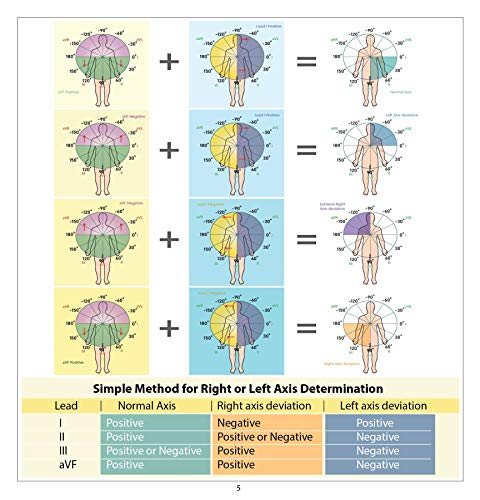 12 Lead EKG Pocket Card