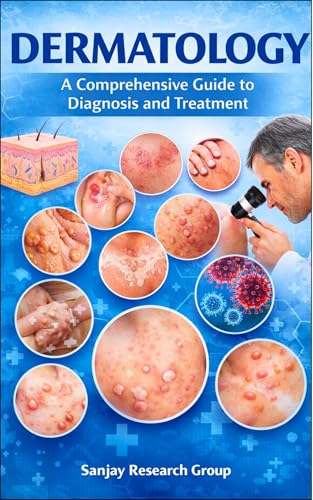 Dermatology: A Comprehensive Guide to Diagnosis and Treatment (Medical Study Books By Sanjay Mandavi Book 3)