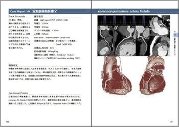 臨床心臓CT学 基礎と実践マネージメント 臨床心臓CT学－基礎と実践マネージメント | 小山 靖史, 鈴木 諭