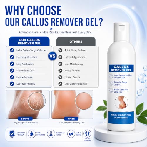 Image of Callus Remover Gel for Feet, Softening and Exfoliating Formula, Dry Rough Skin Care, 200ml, for Men and Women (1)