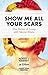 Show Me All Your Scars: True Stories of Living with Mental Illness