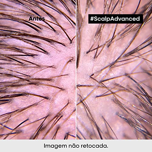 L'Oréal Professionnel Tratamento Condicionante e Calmante Intense Soother, Para Cabelos Oleosos, Ac