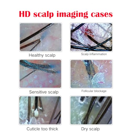Professional Scalp Camera with 11-Inch HD Screen - High-Definition Hair & Scalp Analysis Device for Salons and Spas, Easy to Use, Ideal for Scalp Care & Client Consultations - Image 7