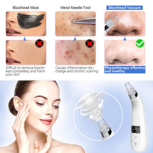 Blackhead Remover Electric Pore Vacuum Acne Comedone Skin Cleaner Blackhead Removal Comedo Extractor Kit 6 Suction Heads Blackhead USB Rechargeable Beauty Device for Facial Skin Treatment