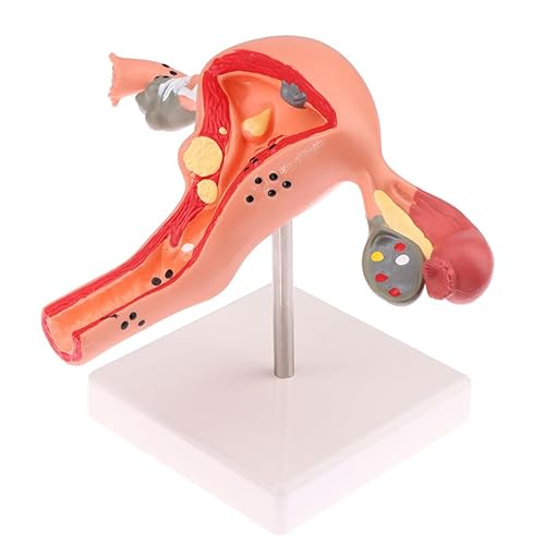 1Pc Medical Props Model Pathological Uterus Ovary Anatomical Model Anatomy Cross Section Study Tool