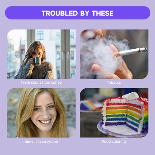 Image of Teeth Whitening Gel Pens V34 Purple Teeth Whitener Non Sensitive 25% Carbamide Peroxide Teeth Color Corrector Whitening, (3X) 4ml / Pen