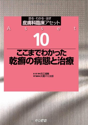 キンドル 無料電子書籍 ここまでわかった 乾癬の病態と治療 (皮膚科臨床アセット) バイ