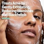 Cetaphil Gentle Clear Pore Clearing Acne Cleanser, Foaming Gel Cleanser for Sensitive, Acne-Prone Skin, 8 Fl Oz Pump Bottle, 2% Salicylic Acid, Gently Exfoliates, Dermatologist Recommended Brand - Image 3