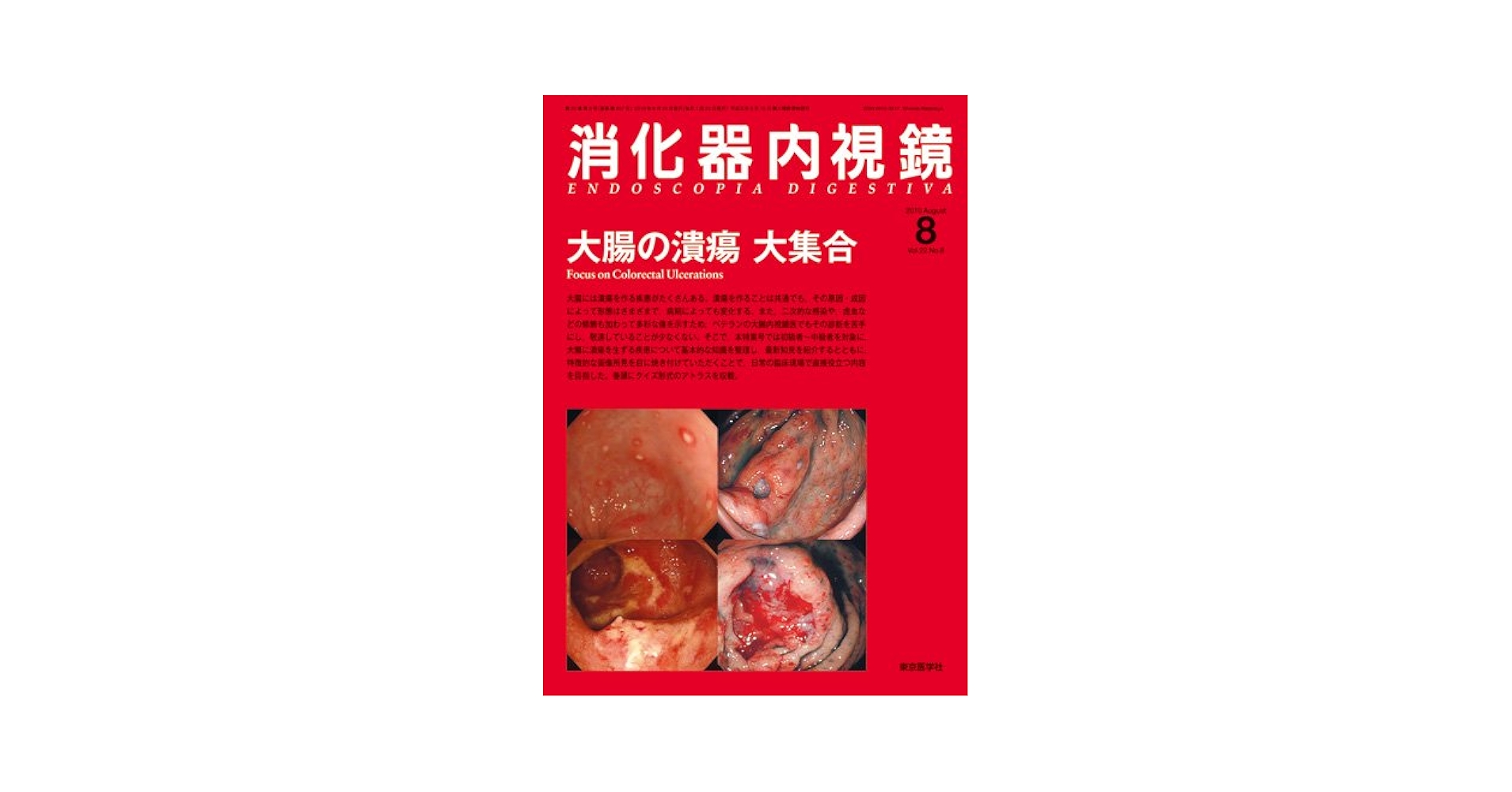 消化器内視鏡第22巻8号　大腸の潰瘍　大集合 (消化器内視鏡2010年8月号) Amazon.co.jp: 消化器内視鏡第22巻8号 大腸の潰瘍 大集合 (消化