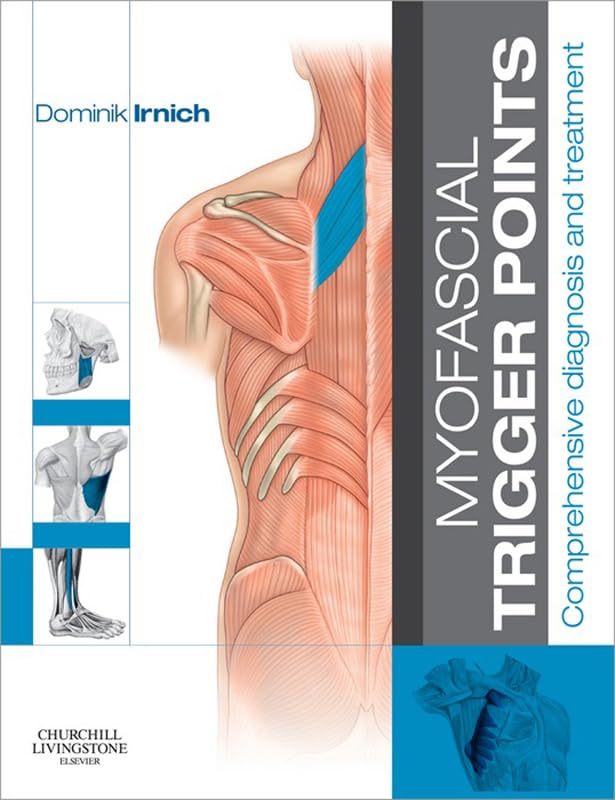Myofascial Trigger Points: Comprehensive diagnosis and treatment