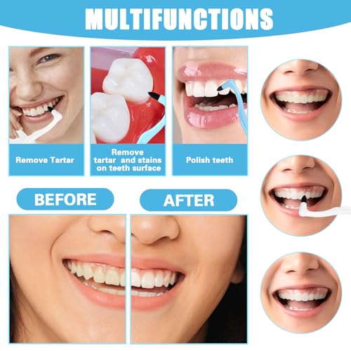 Image of 8 Pcs Tooth Stain Eraser Tartar Polisher Stain Removers Dental Plaque Tartar Eraser Plaque Tool Professional Dental Picks Cleaning Professional Tools Teeth Cleaning Kit for Oral Care White and Blue