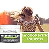Pink Madison Dark Spot Corrector Best Age Spot Remover Treatment for Face Hands Body Circle 4 Ounce Cream