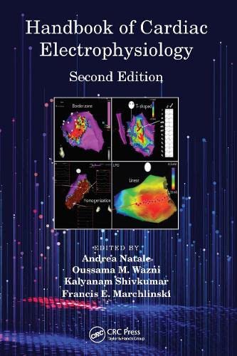 Handbook Of Cardiac Electrophysiology 2Ed (Pb 2021)