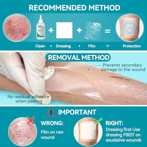 Image of Dimora Waterproof Transparent Film Dressing, Clear Bandage Tape for Wound Care, Adhesive Post Surgical Cover Pad,for IV Shield, Tattoo Aftercare, Shower Protector 4x4 3 /4 inch 100 Packs
