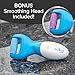 PedEgg Power Cordless Motorized Callus Remover w/ Bright LED Light As Seen On TV, Quickly Removes Calluses & Dry Skin w/ 2000 RPMs of Spinning Action for Smooth, Soft Feet, Easy-Grip Ergonomic Handle