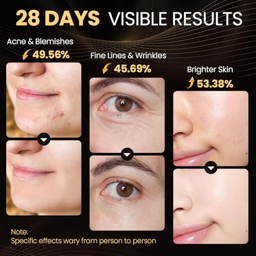 LED-Face-Mask-Light-Therapy-Enhance-Red-Light-Therapy-Mask-for-Face-Acne-Wrinkles-Skin-Rejuvenation-3-Light-Modes-Timing-Settings-Eye-Protection-Portable-LED-Face-Mask-Home-Skincare