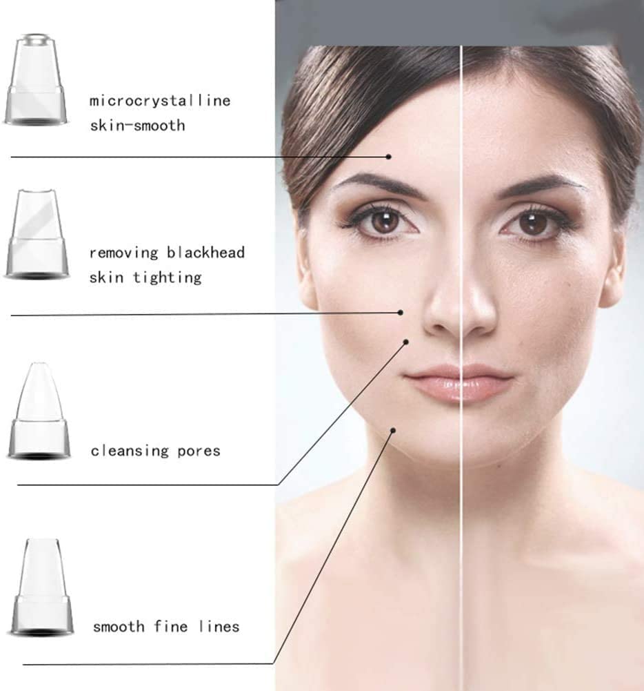 Extracteur de Points Noirs, Outil d'élimination des Points Noirs, aspirateur Facial électrique Rechargeable par USB, Outil d'élimination des Points Noirs avec 4 sondes d'aspiration