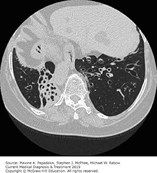 CURRENT Medical Diagnosis and Treatment 2019: 9781260117431