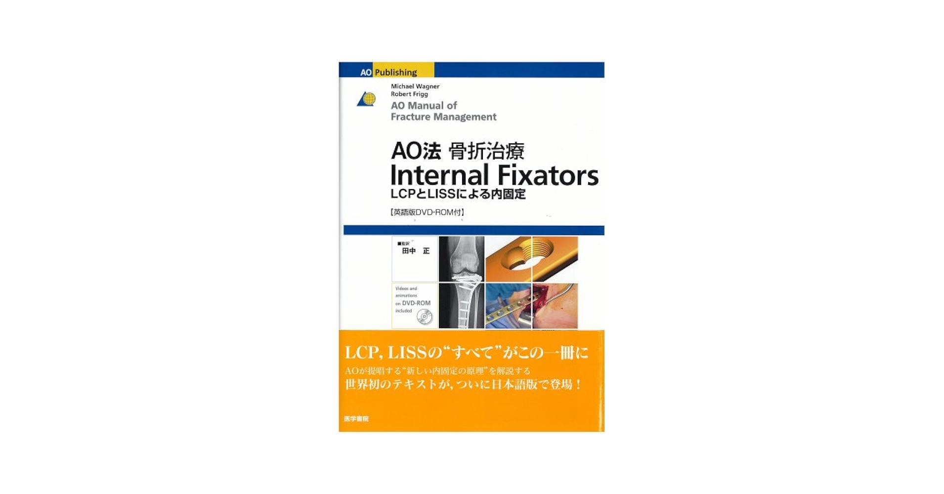AO法骨折治療Internal Fixators[英語版DVD-ROM付]　LCPとLISSによる内固定 Michael Wagner、 Robert Frigg; 田中 正 AO法骨折治療 Internal Fixators [英語版DVD-ROM付] | 書籍詳細