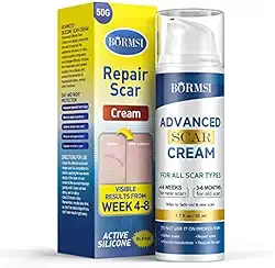 Creme para cicatrizes, gel ativo de silicone dimeticona para cicatrizes antigas para cicatrizes cirúrgicas, estrias, queimaduras, queloides, tratamento para acne (50 g)