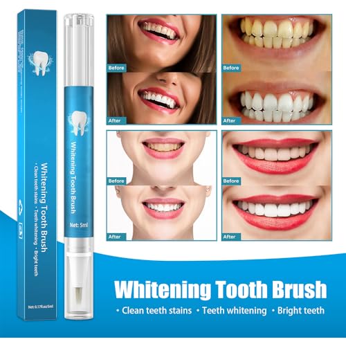 Image of Teeth Whitening Pen (2 Pcs), 20+ Uses, Teeth Whitening Brush Pens Kit, Teeth Whitening Gel Pen Teeth Whitener, Effective, Painless, No Sensitivity, Travel-Friendly, Easy to Use, 2 x 5ml