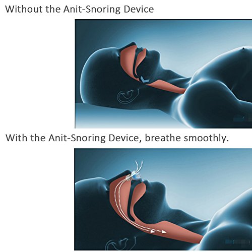 AZGEEK Naso Snore Stopper Anti russare sollievo